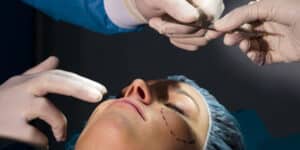 Social media and plastic surgery