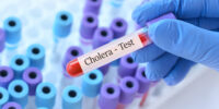 Cholera outbreak in Zimbabwe